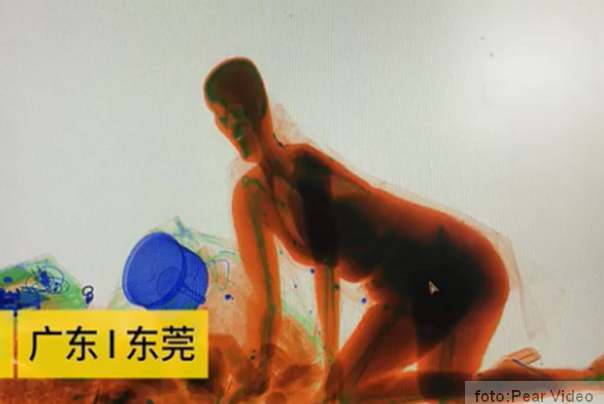 prošla kroz redgen aparat