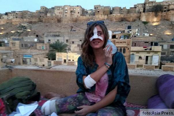 studetkinja Mellisa Meville nakon napada krave studetkinja Mellisa nakon napada krave