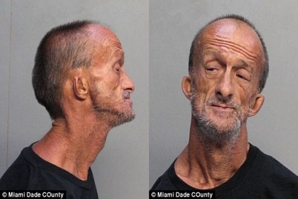 Džonatan Krenšov je bez ruku napao mladića