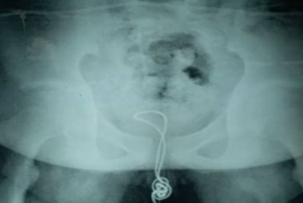 USB kabal u dečakovoj be&scaron;ici