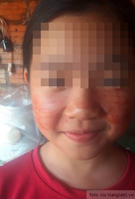 devojčicino liceo oznojano od krvi devojčicino liceo oznojano od krvi