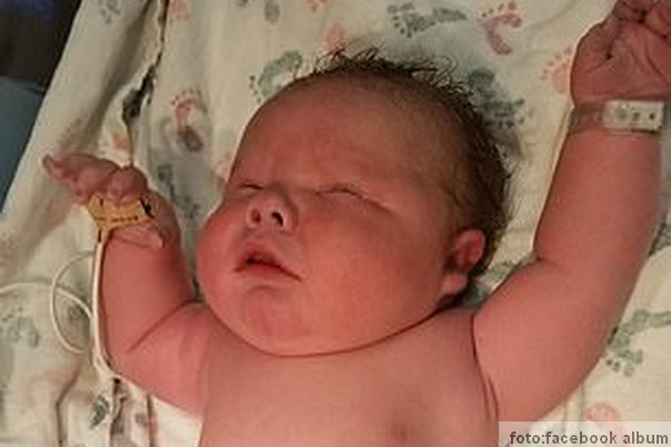 beba od 7kg rođena u teksasu