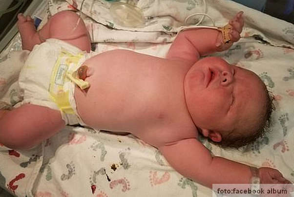 beba 7kg težine rođena u teksasu