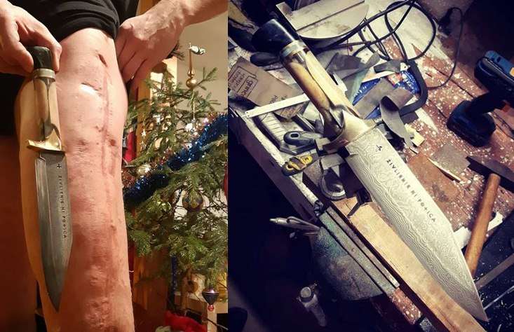 Morenova noga posle oporavka i nož