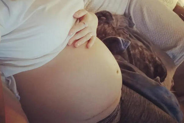 Betin trudnički stomak posle opreacije