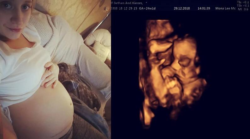 beba operacija betani