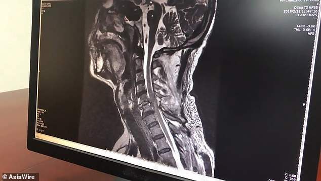 Liujev  vrat nakon incidenta  FOTO: Asia wire