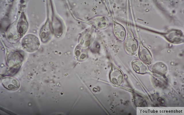 Henneguya salminicola životinja koja ne diše