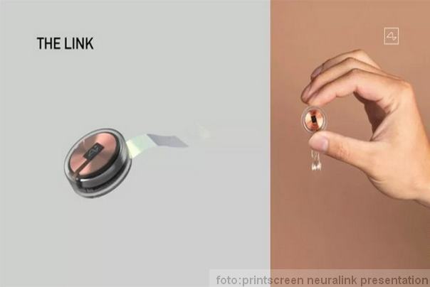 link čip neuralink