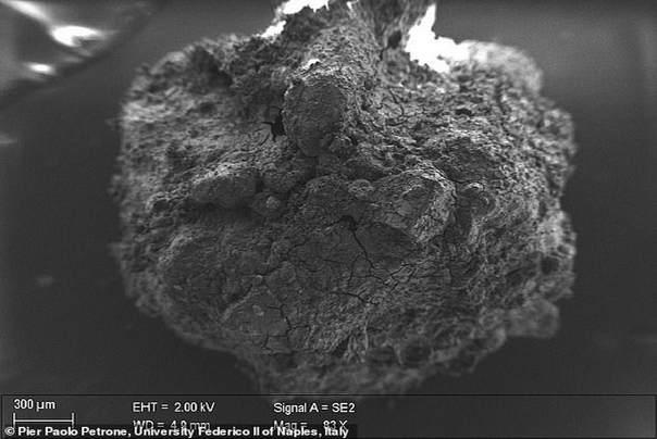 celije mozga ostaci2