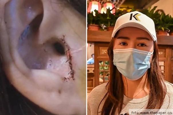 slika prikazuje do uha koji joj fali