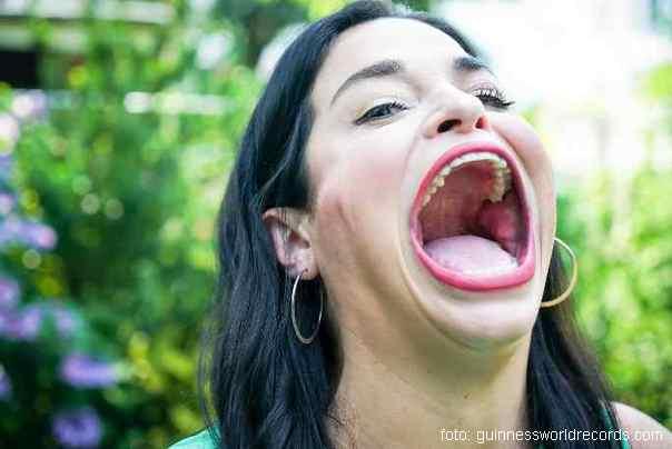 Samantina otvorena usta