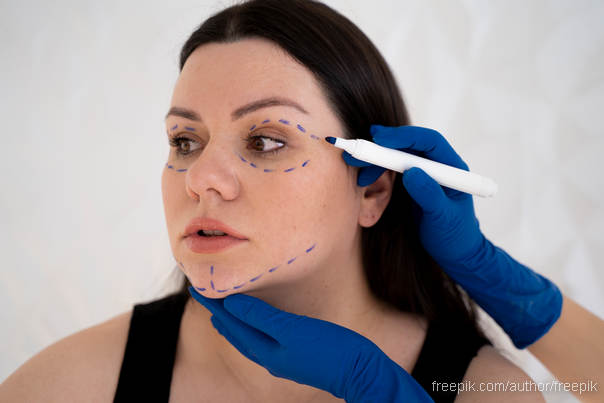 plastična hirurgija