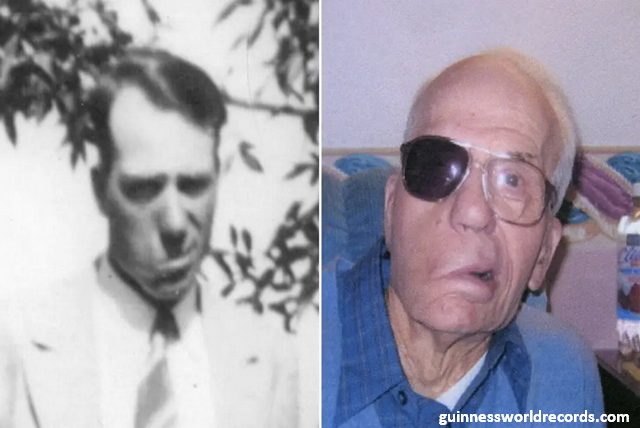 rekord metak u glavi