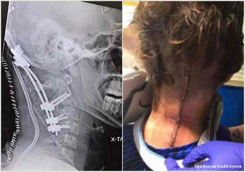 Snimak lobanje i kičme