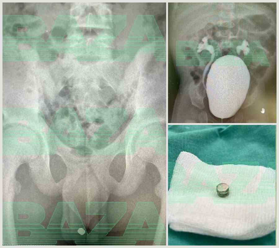 regdenski snimak 13-godi&scaron;njaka