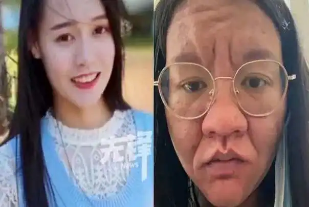 fizička transformacija trudnoća