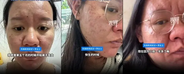 trudnoća transformacija