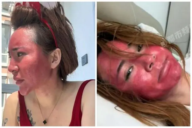 lice kineskinje nakon neskidanja šminke 20 godina