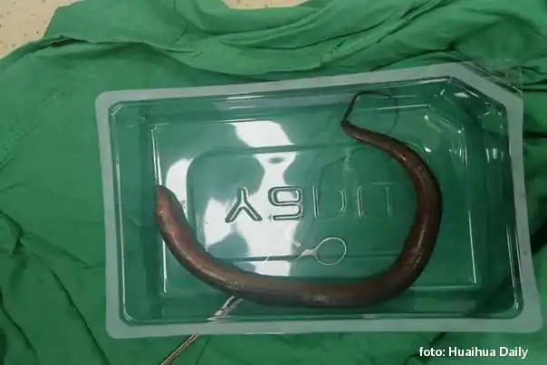 živa jegulja iz stomaka