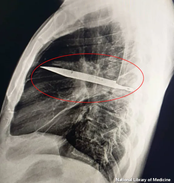 nož u grudima Tanzanijca