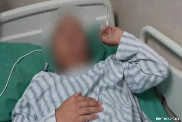 UKLONILI mu IZ MOZGA CRVA od 18 centimetara