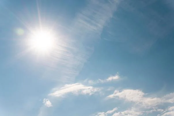 Žena koja ne sme na sunce zbog retke bolesti!